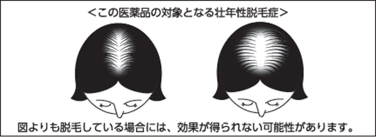 ミノリーナ効能効果